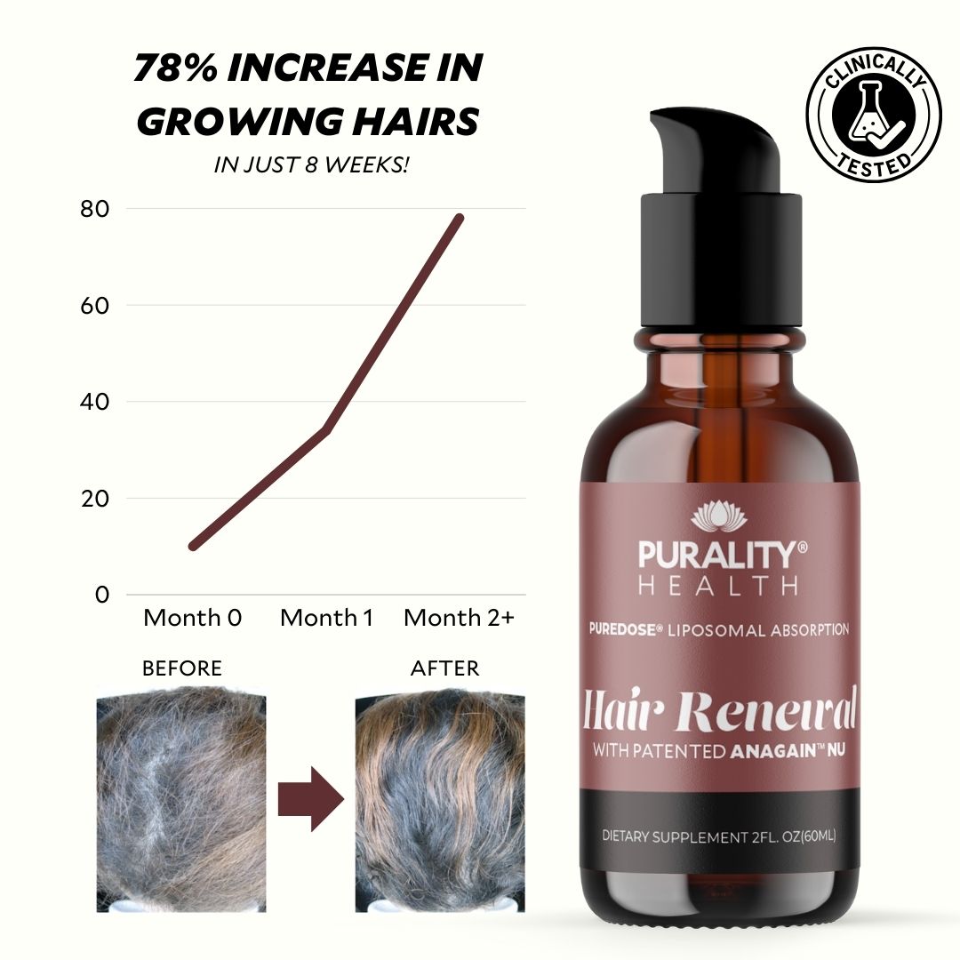 Liposomal Hair Renewal supplement